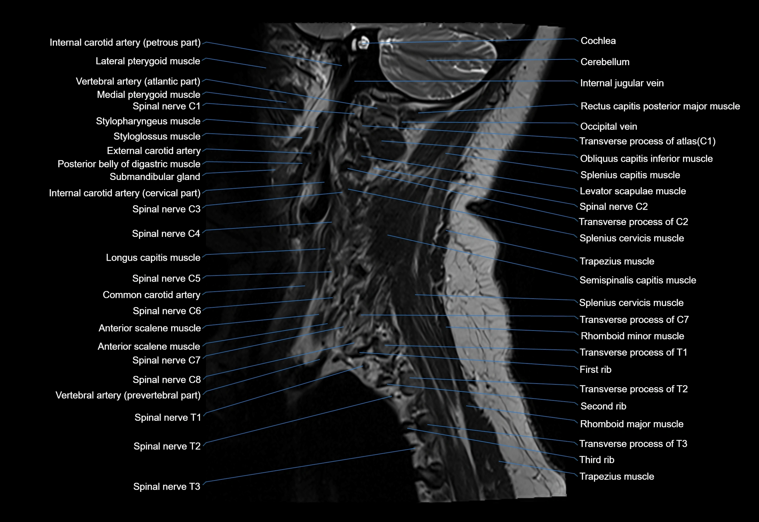 cervical spine cross sectional MRI anatomy 3T MRI  sagittal image-img-00001-00004.webp
